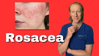 Your Guide to Rosacea From Skin Redness to Emotional Wellness [upl. by Areemas]