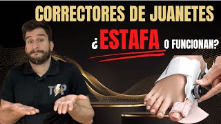 Correctores de juanetes ¿funcionan o son una estafa [upl. by Aser878]