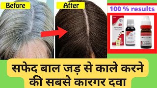 Safed balon ko kala karne ka ilaj Homeopathic medicine for premature grey hairs [upl. by Aisayn923]