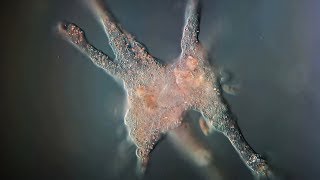 How dangerous are braineating Amoeba [upl. by Leinahtan]