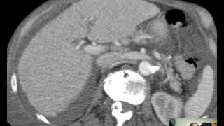 CT Thorax Anatomy DISCUSSION 37min [upl. by Enrica554]