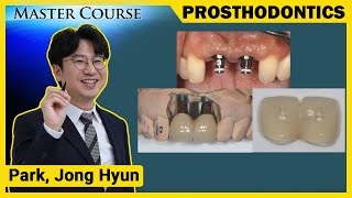 Master Course Season2 PROSTHODONTICS Aesthetic Impression Taking in the Anterior Region [upl. by Alios]