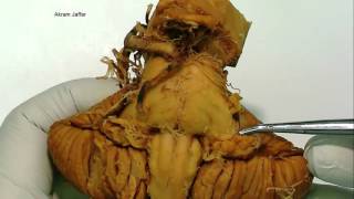 Cerebellum  gross anatomy [upl. by Ehman326]