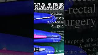 Introducing MAARS  Minimal Access Ano Rectal Surgerycall 9820274383 piles fissure fistulainano [upl. by Paz]