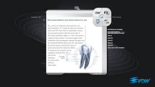 VDW Dental · How To Mtwo  Root canal preparation [upl. by Barrada287]