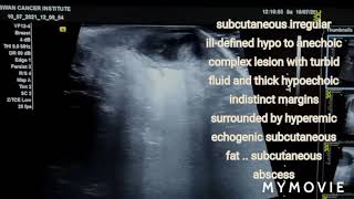 subcutaneous abscess  ultrasound case [upl. by Woodman]