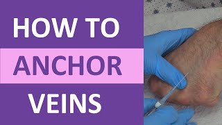 How to Anchor Veins  Venipuncture IV Therapy Blood Draw Phlebotomy Rolling Veins [upl. by Punak]