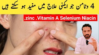 Top 4 Vitamins for Quick Acne Treatment Acne Vulgaris [upl. by Eseret129]