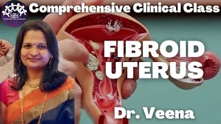 Fibroid Uterus  OBG Clinical Case presentation [upl. by Selry896]