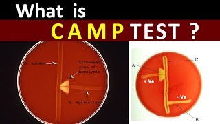 Why amp What is CAMP Test   Clear Explain [upl. by Ilario]