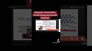 Polygraph reading and interpretation Normal Tracing and Specific response [upl. by Doolittle318]