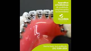 O tratamento para um sorriso perfeito você encontra na DenteBelo 😁✨ dentista dentebelo aparelhos [upl. by Warrin]