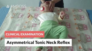 Asymmetrical Tonic Neck Reflex  Clinical Examination [upl. by Myrtia]