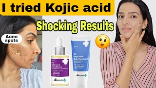 Derma co Kojic acid face wash and serum for 1 month  Honest Review skincare [upl. by Ellerehs]