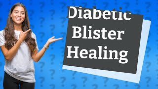 How long does it take for a diabetic blister to heal [upl. by Assirk613]