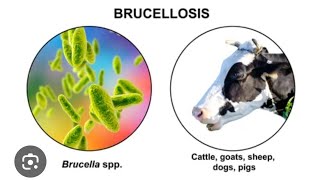 Mystery diagnosis Brucellosis [upl. by Cesaro]