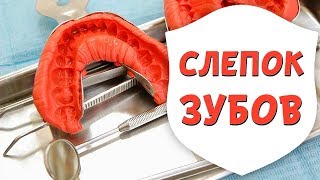 Слепок зубов для брекетов  весь процесс Материалы для изготовления оттиска  Доктор Д  Дентал ТВ [upl. by Ailido]