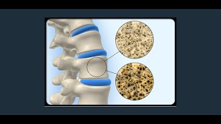 Disorders of Muscular and Skeletal System [upl. by Enirrok594]