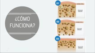 LIPOCELLCRIO Criolipólisis por Starbene [upl. by Gnuh]