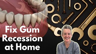 How To Regrow Receding Gums Holistic Dentist Reveals [upl. by Nhaj]