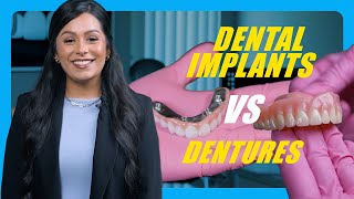 Dental Implants vs Dentures [upl. by Relluf]