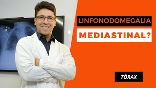 APRENDA A INTERPRETAR LINFONODOMEGALIAS MEDIASTINAIS [upl. by Ehud742]