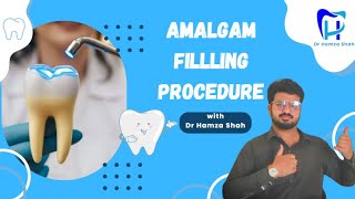 Amalgam Preparation amp Restoration  Amalgam Filling procedure  Operative Dentistry [upl. by Onitnatsnoc660]