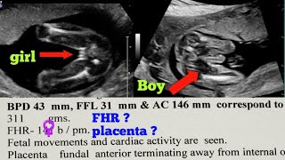 Pregnancy Ultrasound Report Kaise Dekhe  Pregnancy Ultrasound Report Boy Or Girl  Fhr Of Male Baby [upl. by Starbuck19]