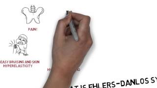 What is EhlersDanlos syndrome  Educational Video [upl. by Aileon]