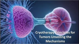 Cryotherapy Principles for Tumors Unveiling the Mechanisms [upl. by Galer]