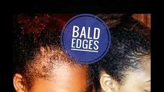 How I use GINGER AND CASTOR OIL TO REGROW MY BALD EDGES  GINGER HAIR MASK FOR EXTREME HAIR GROWTH [upl. by Wesle]