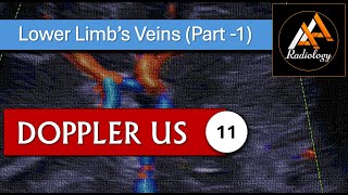 11  Lower Limbs Veins Part  1 [upl. by Barbara774]