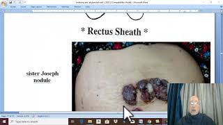 Anatomy GIT module in English 2021  Rectus sheath   by Dr Wahdan [upl. by Nielsen]