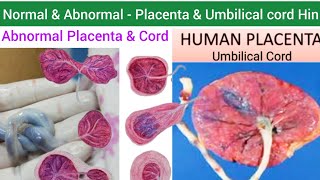 Human Placenta  Structure Function amp Abnormalities of Placenta amp Umbilical cord  Umbilical Cord [upl. by Alegna]