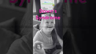 Down’s Syndrome  Principles of Inheritance and Variation  Chromosomal Disorder  Class 12 Biology [upl. by Lucila703]