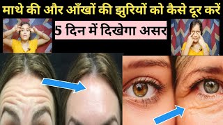 How To Remove Forehead amp Eye Wrinkles ❓️माथे और आंखों की झुर्रियां 5 दिन में गायब करने का सरल तरीका [upl. by Lladnarc]