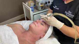 Microdermabrasion Facial Demonstration [upl. by Peatroy]