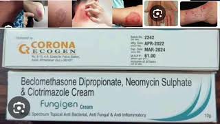 Fungigen Cream Beclomethasone Dipropionate Neomycin Sulphate amp Clotrimazole Cream [upl. by Sigismundo]