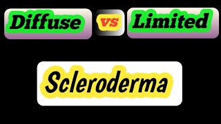 diffuse vs limited scleroderma [upl. by Sigrid600]