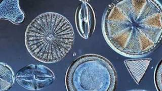 Beautiful Diatoms [upl. by Fanchet42]