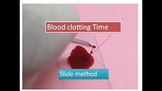 Blood clotting time without use of filter paper  slide method [upl. by Erialc]