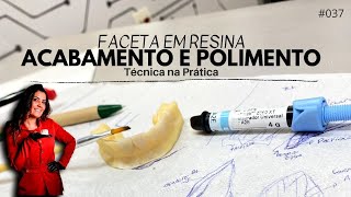 Faceta de Resina  Acabamento e Polimento  Técnica Na Prática 037 [upl. by Aidualk]