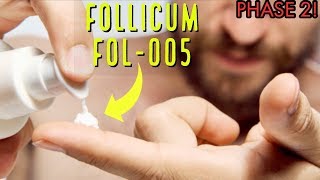 HUGE UPDATE FOLLICUM FOL005 HAIR GROWTH TREATMENT [upl. by Einttirb36]