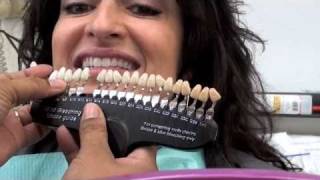 Teeth Whitening in the Salon to Make more Money [upl. by Eiliah]