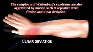 Entrapment of Radial Nerve Wartenbergs Syndrome  Everything You Need To Know  Dr Nabil Ebraheim [upl. by Marcella]