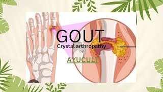 GOUT  WITHIN 15 MINUTES  STUDY MADE SIMPLE AND EASY [upl. by Myer212]