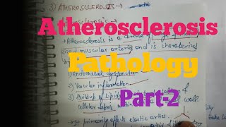 Atherosclerosis Part  2 Pathology [upl. by Anema263]