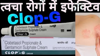 CLOPG Cream Uses in Hindi  Clobetasol Propionate amp Gentamicin Sulphate Cream [upl. by Acemahs116]