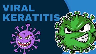 Viral keratitis  Virus  OPHTHALMOLOGY PrepLaddermedpg marrowmed [upl. by Oreste]