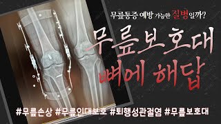 무릎보호대의근본관절염예방무릎보호대무릎보호대추천브렉코리아브렉무릎보호대인공관절운동용보호대퇴행성관절염무릎보조기보조기착용법보호대착용법줄기세포맞춤제작무릎보호대BREG [upl. by Massab]